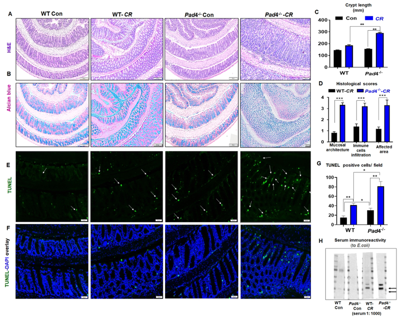 PAD4-dependent NETs generation are indispensable for intestinal ...