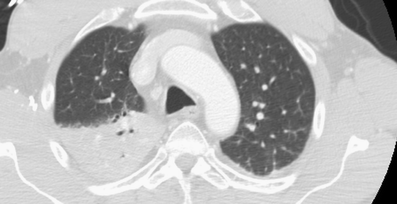 Fig. 5