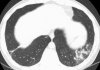 Fig. 6