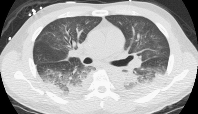 Fig. 4