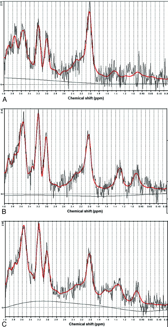 Fig 2.