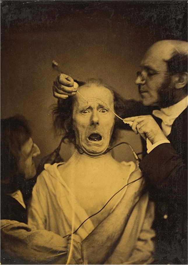 Fig. 1