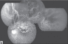 Figure 2b