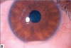 Figure 1a