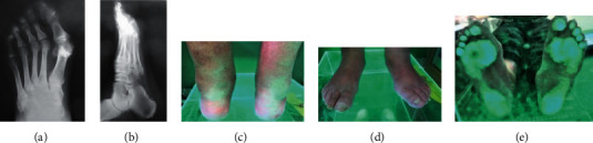 Figure 5