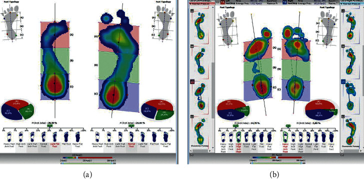 Figure 12