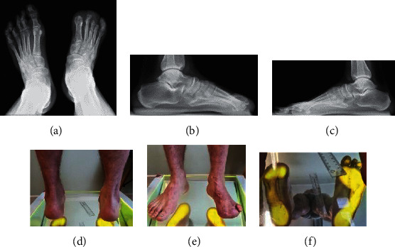 Figure 9