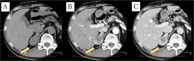 Fig 4