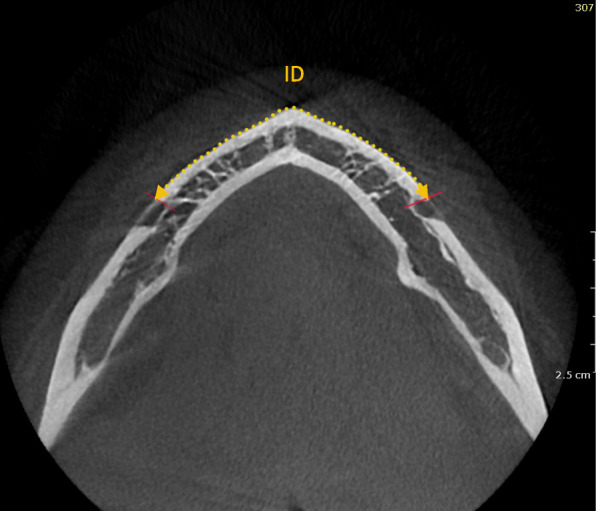 Fig. 3