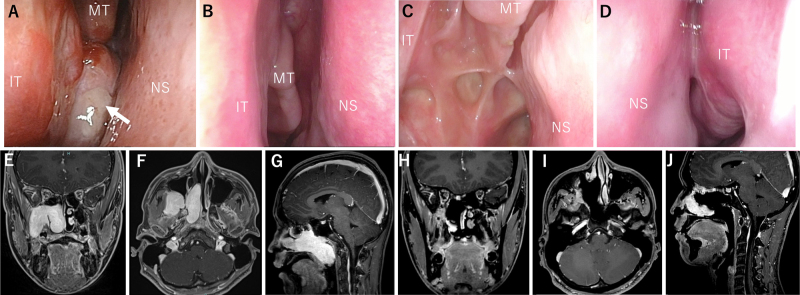 FIG. 3.