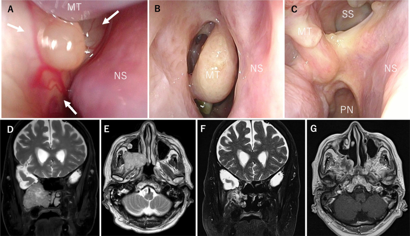 FIG. 5.