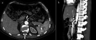 Fig. 17