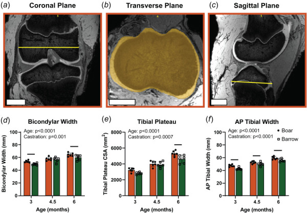 Barrows have smaller joints than boars throughout growth. Joint size measurements taken from the (a) coronal, (b) transverse, and (c) sagittal planes from the MRI scans. Quantitative comparison of (d)bicondylar width, (e) tibial plateau CSA, and (f) AP tibial width measurements between boars and barrows across three ages tested, where each point represents an independent specimen. Data presented as mean ± 95% confidence interval with main effects from two-way ANOVA shown in graph corner. Bars indicate p < 0.05 between boars and barrows within ages.