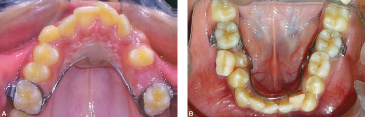 Figs 13A and B