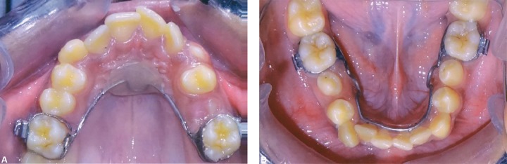 Figs 14A and B