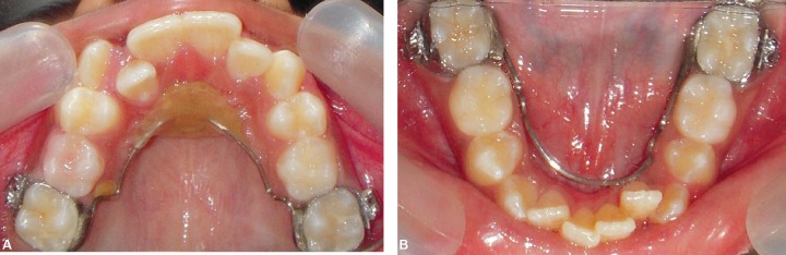 Figs 4 and B