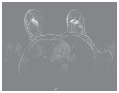 Figure 1b