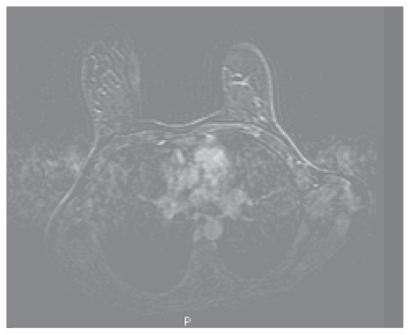 Figure 1c