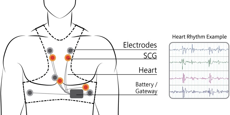 Fig 2