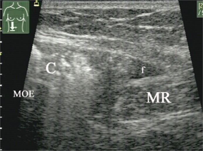 Fig. 5 B