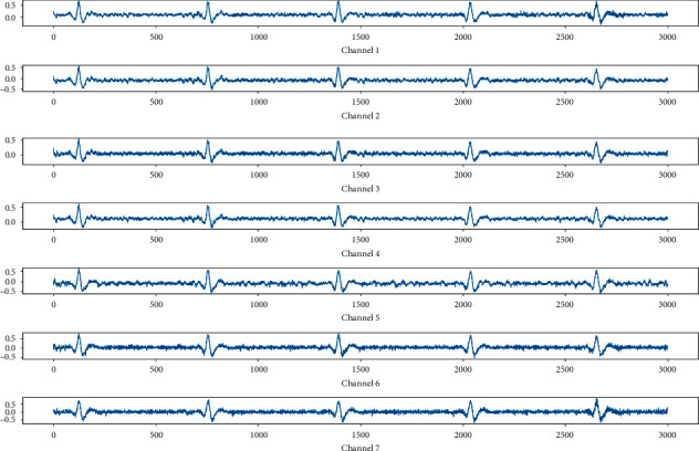 Figure 17