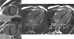 Fig. 14