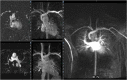 Fig. 12
