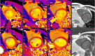 Fig. 18