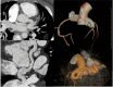Fig. 13