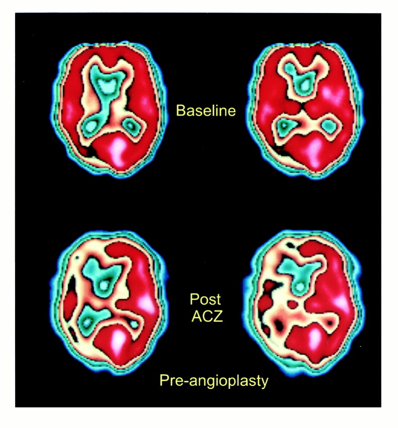 fig 1.