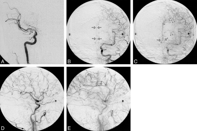 fig 2.