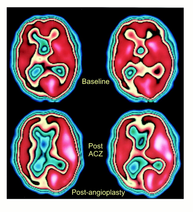 fig 3.