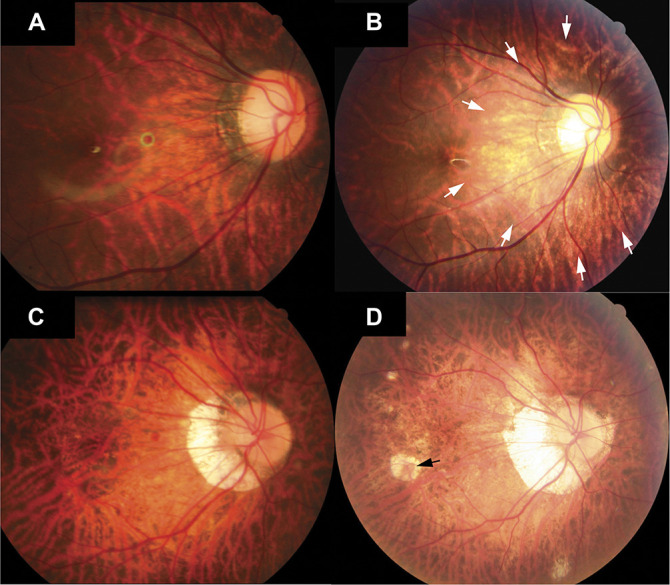 Fig. 3.