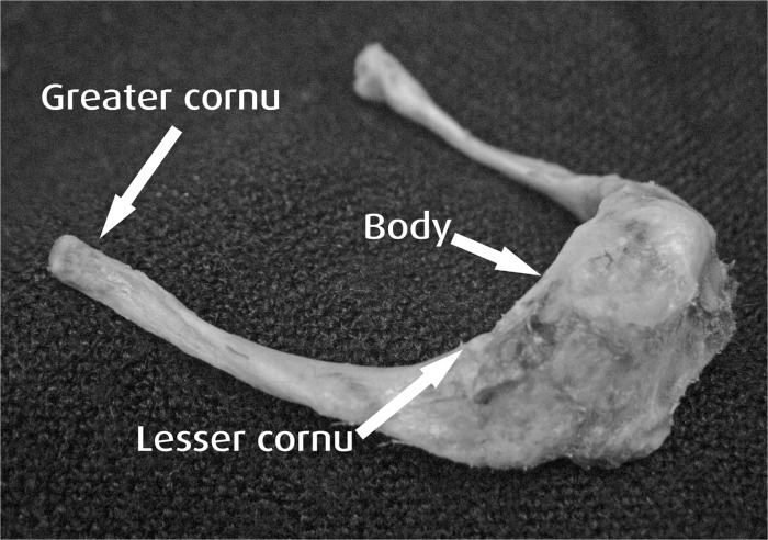 Figure 1: