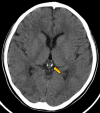 Fig. 3