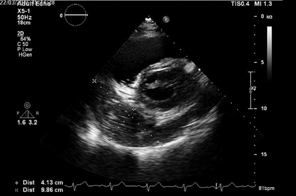 Figure 2