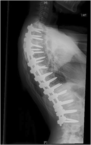Figure 13