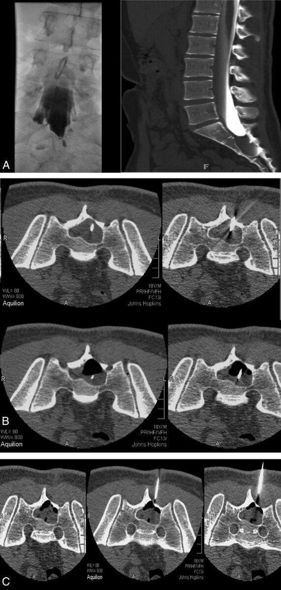 Fig 2.