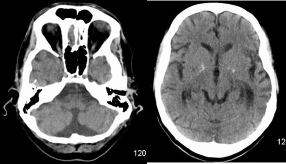 Figure 1