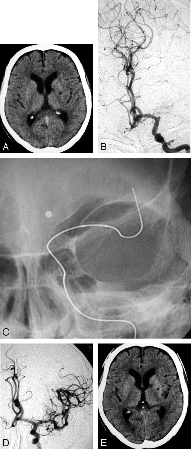 Fig 2.