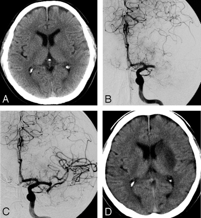 Fig 3.