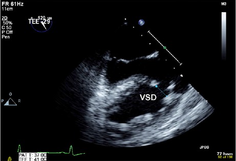 Fig. 3.