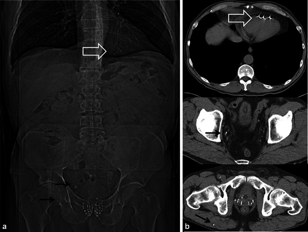 Fig. 16