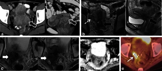 Fig. 15