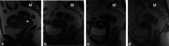 Fig. 11