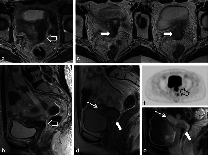 Fig. 12