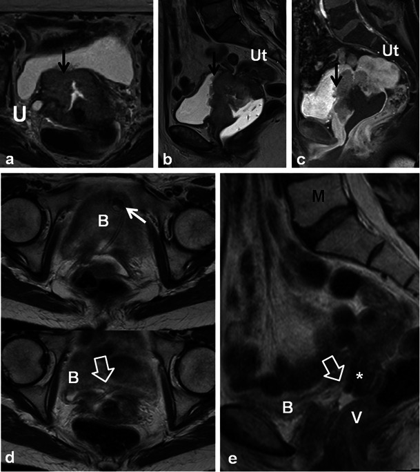 Fig. 13