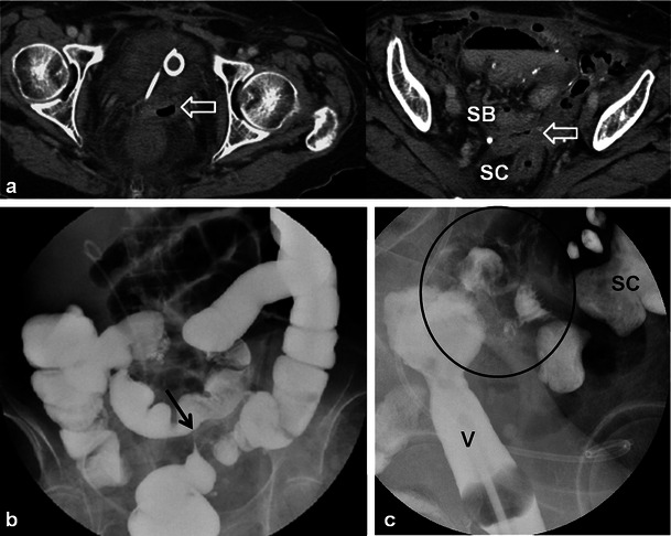 Fig. 14