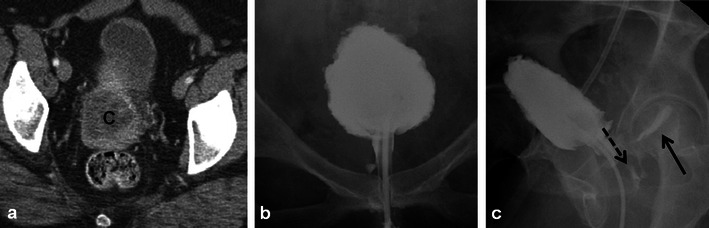 Fig. 6