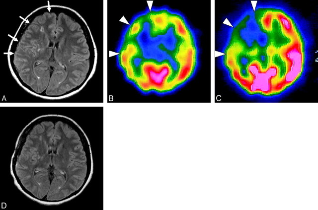 Fig 6.